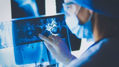 Doctor looking at xrays regarding information on Roundup possibly causing cancer