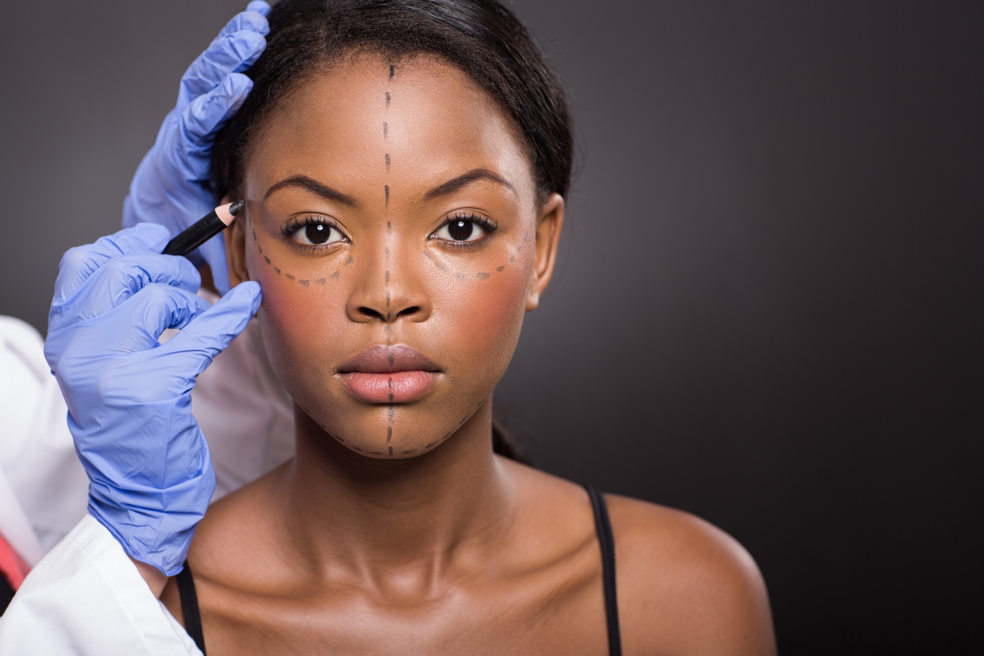 Woman prepping for plastic surgery regarding the Dr. 6ix class action lawsuit filed