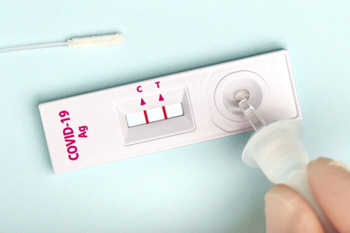 antigen pcr express test macro. The test showed a positive result