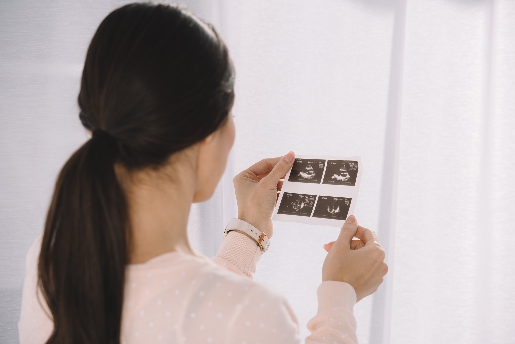 mother looking at ultrasound photo